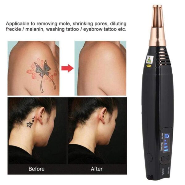 Red And Blue Facial Beauty And Spot-sweeping Pen Home Beauty Instrument